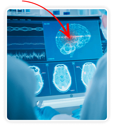 BRAIN